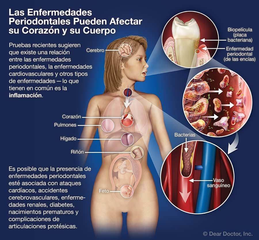 Ilustración conexión boca y salud general