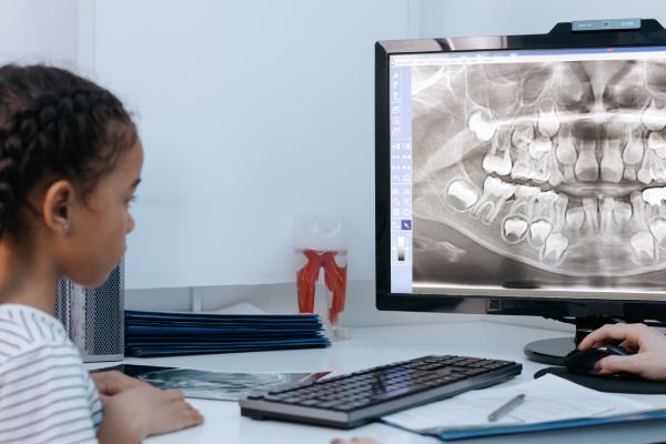 Img post Dientes cónicos: qué son y cómo se pueden arreglar
